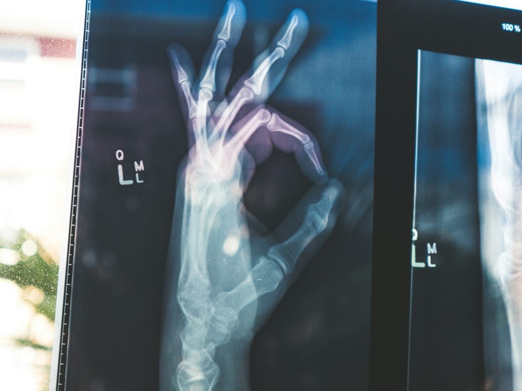 X ray scan as Google will make its powerful new MedGemma AI models open-source to provide powerful tools to healthcare developers.